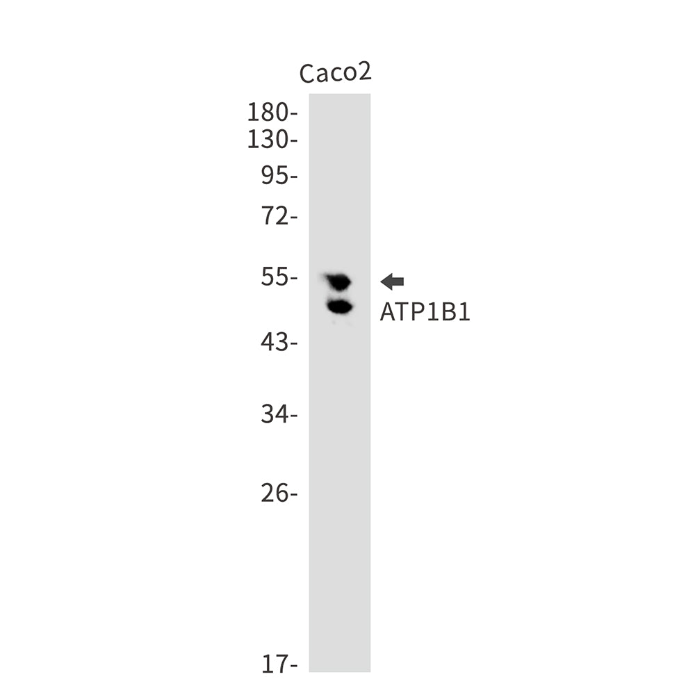 ATP1B1 Rabbit Monoclonal Antibody