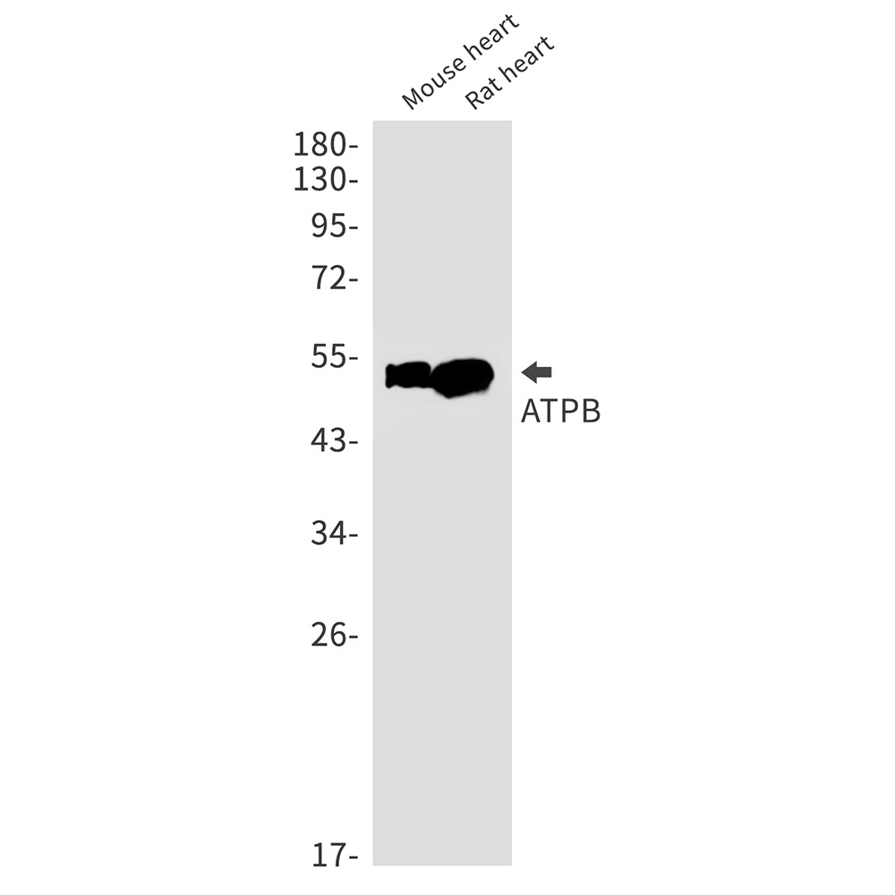 ATPB Rabbit Monoclonal Antibody