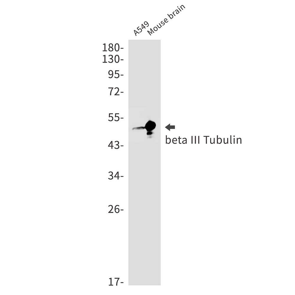 beta III Tubulin Rabbit Monoclonal Antibody