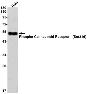Phospho-Cannabinoid Receptor I (Ser316) Rabbit Monoclonal Antibody