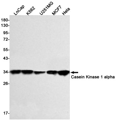 Casein Kinase 1 alpha Rabbit Monoclonal Antibody