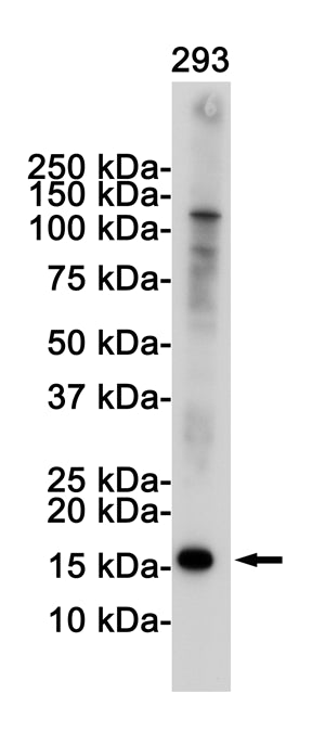 CDKN2A/p16INK4a Rabbit Monoclonal Antibody