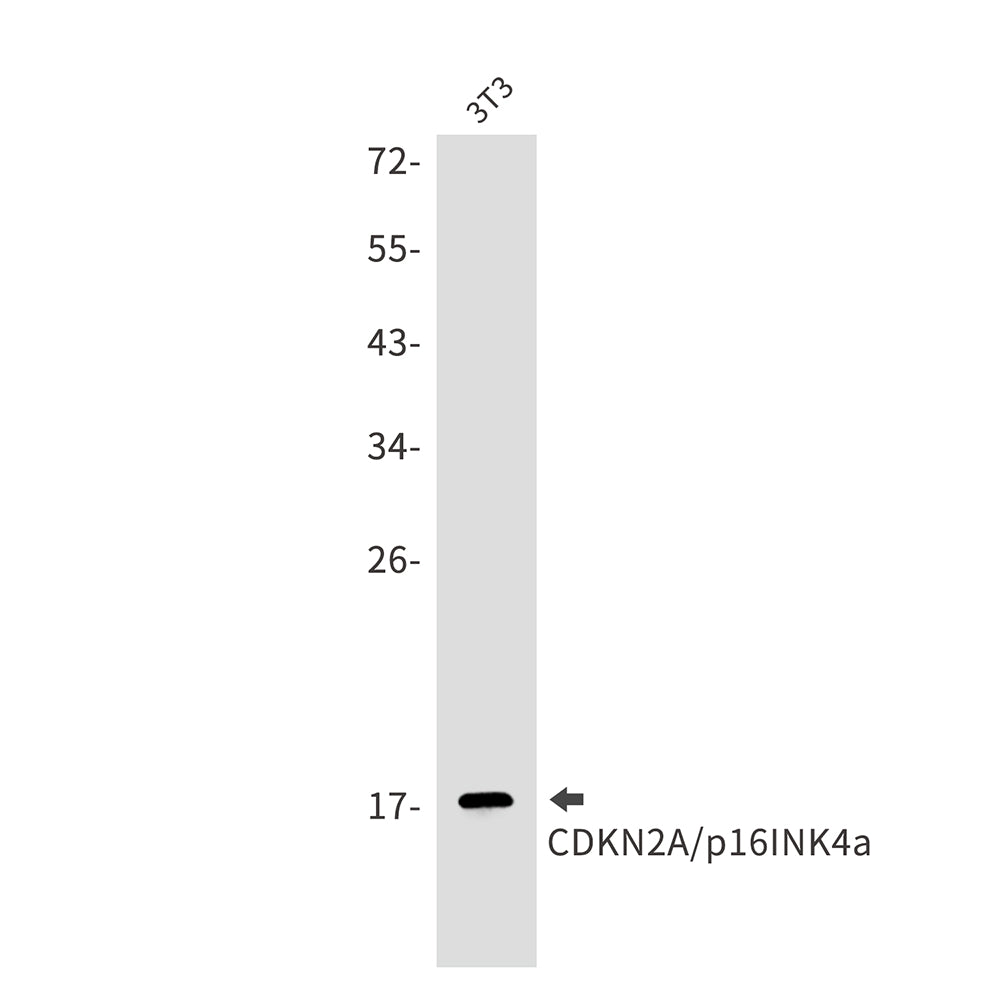 CDKN2A/p16INK4a Rabbit Monoclonal Antibody