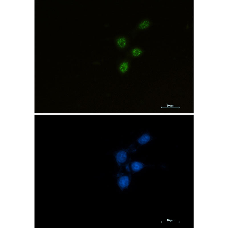 Chk2 Rabbit Monoclonal Antibody