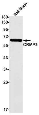 CRMP3 Rabbit Monoclonal Antibody