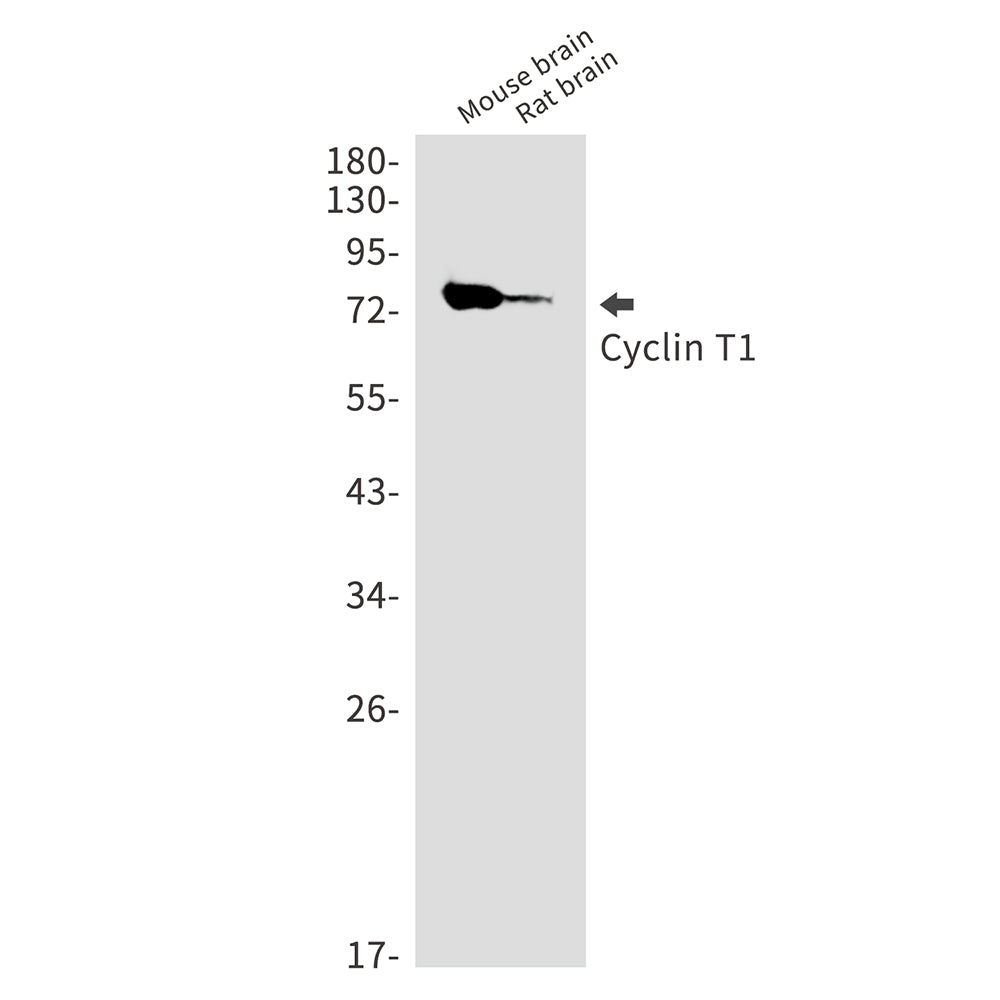 Cyclin T1 Rabbit Monoclonal Antibody