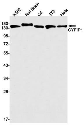 CYFIP1 Rabbit Monoclonal Antibody