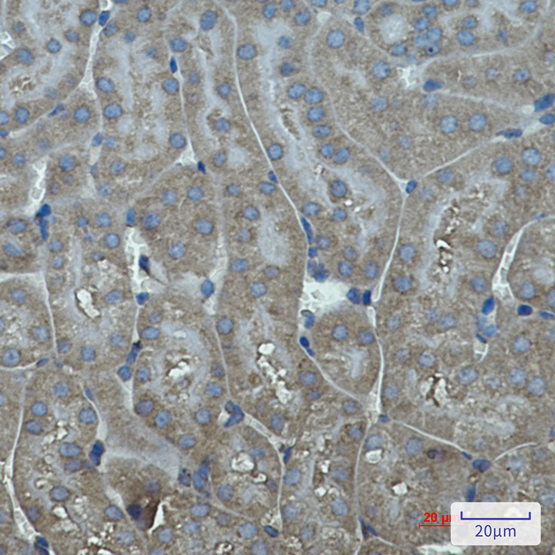 Cytochrome P450 17A1 Rabbit Monoclonal Antibody