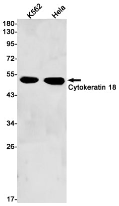 Cytokeratin 18 Rabbit Monoclonal Antibody