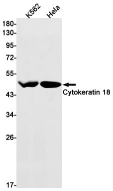 Cytokeratin 18 Rabbit Monoclonal Antibody