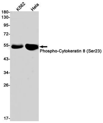 Phospho-Cytokeratin 8 (Ser23) Rabbit Monoclonal Antibody