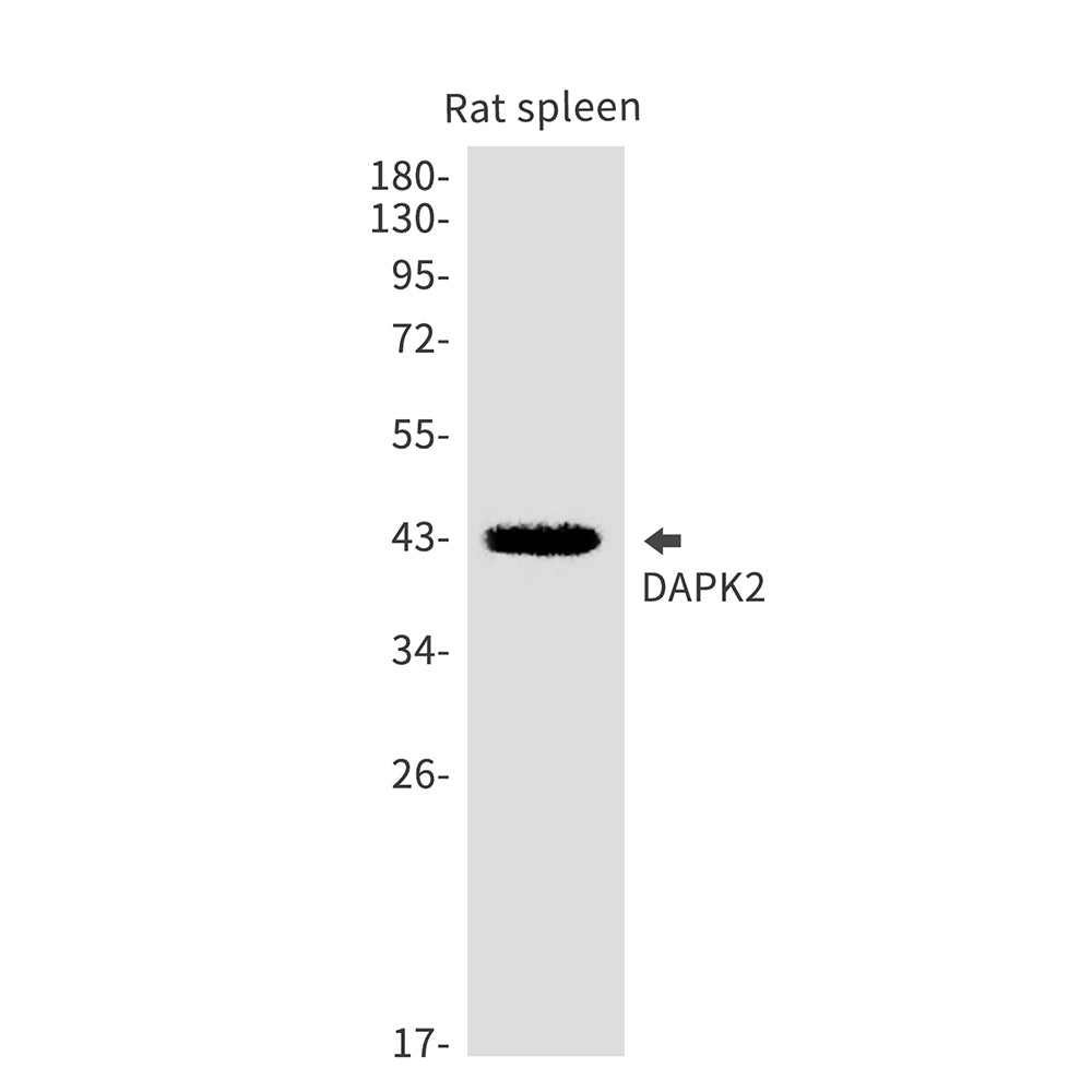 DAPK2 Rabbit Monoclonal Antibody