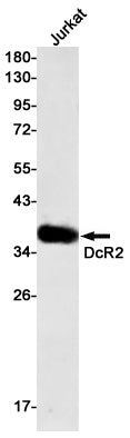 DcR2 Rabbit Monoclonal Antibody