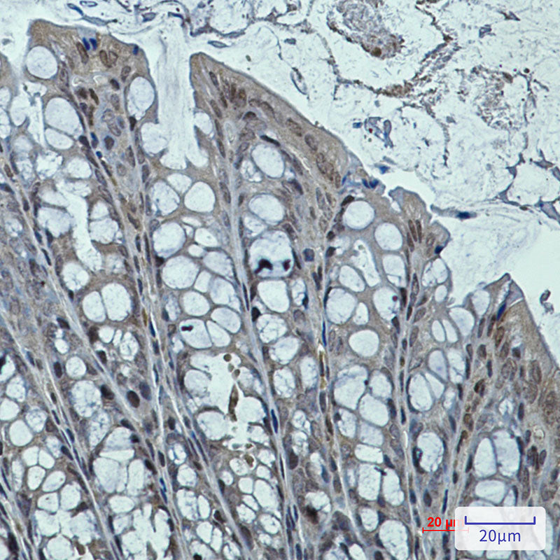 DNAJB6 Rabbit Monoclonal Antibody