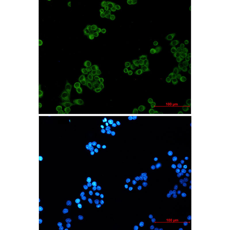 EHD1 Rabbit Monoclonal Antibody