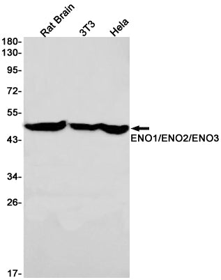 ENO1/2/3 Rabbit Monoclonal Antibody