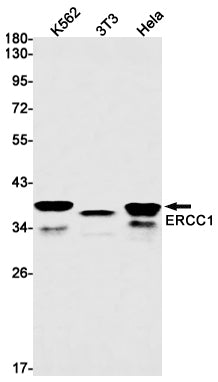 ERCC1 Rabbit Monoclonal Antibody