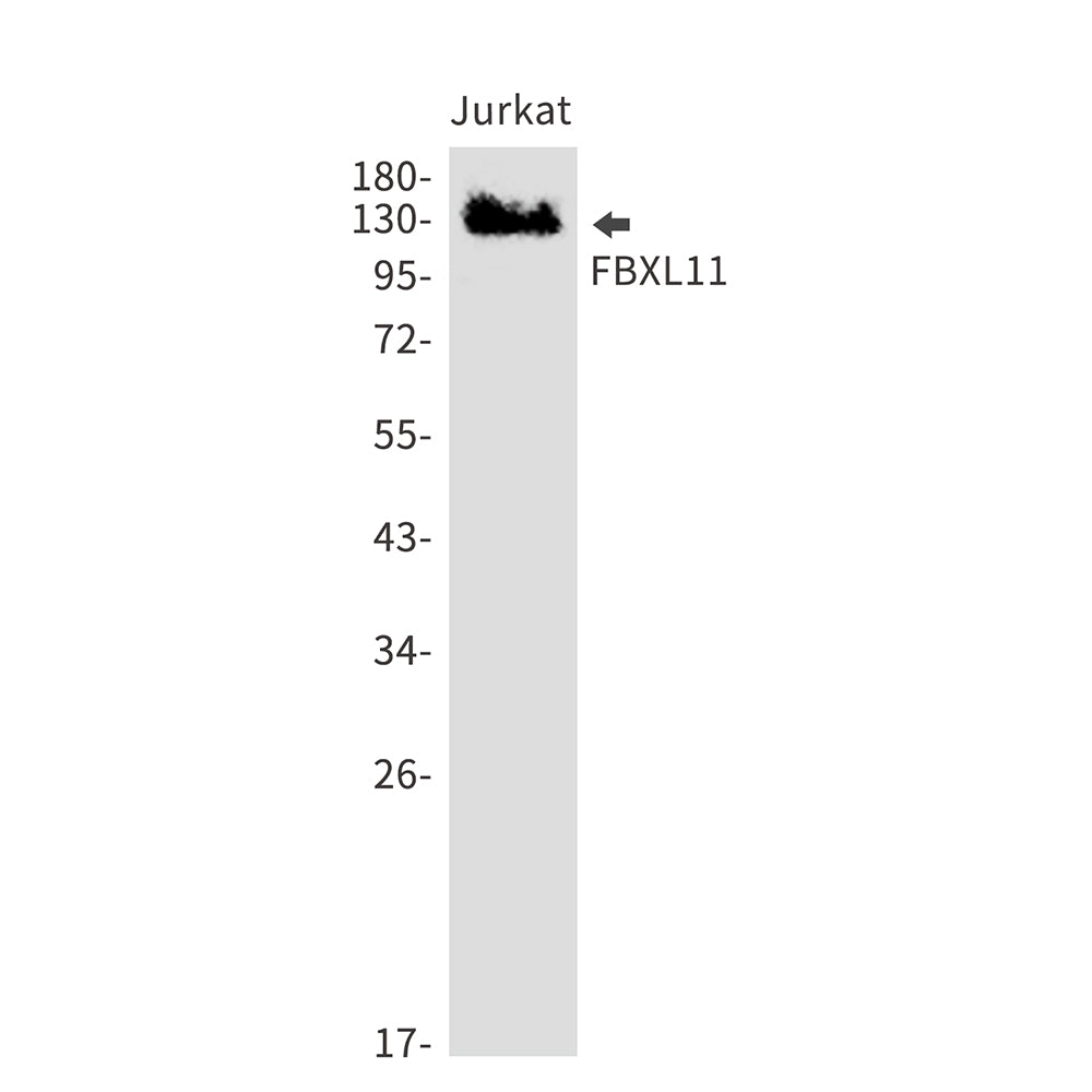 KDM2A Rabbit Monoclonal Antibody