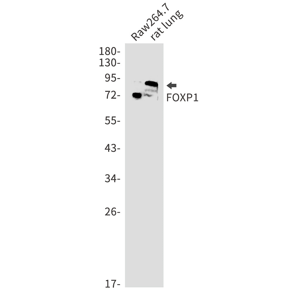 FOXP1 Rabbit Monoclonal Antibody