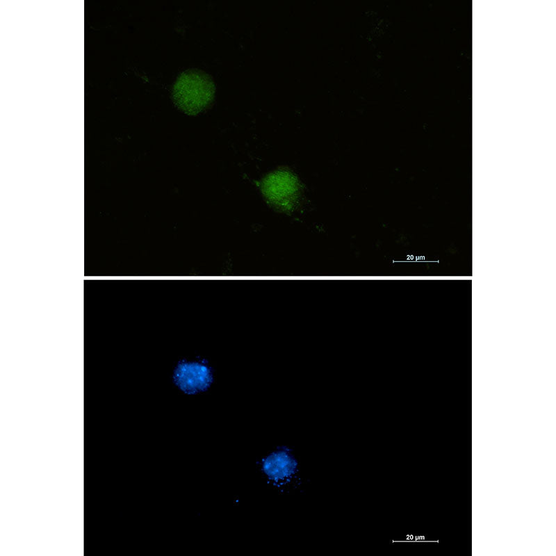 FUBP1 Rabbit Monoclonal Antibody