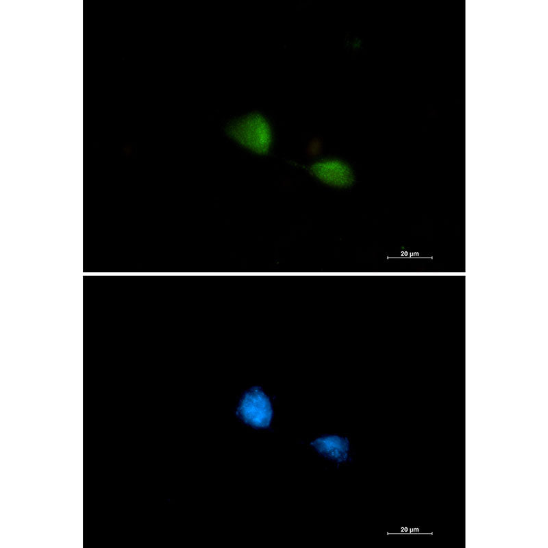 FUBP1 Rabbit Monoclonal Antibody