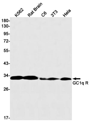 GC1q R Rabbit Monoclonal Antibody