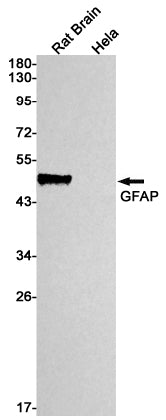 GFAP Rabbit Monoclonal Antibody