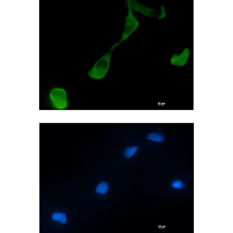 GFPT2 Rabbit Monoclonal Antibody