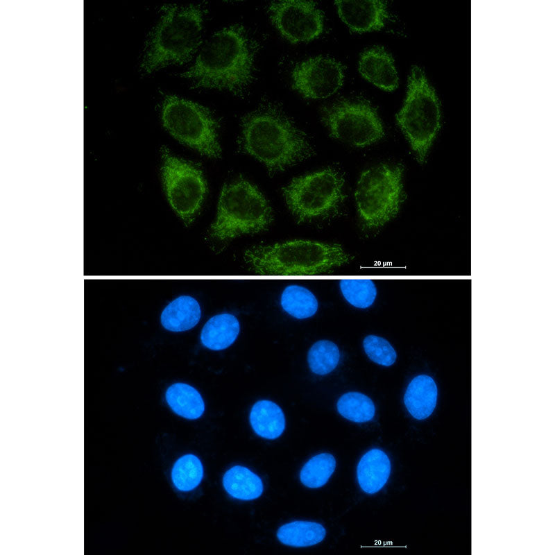 Glutaminase Rabbit Monoclonal Antibody
