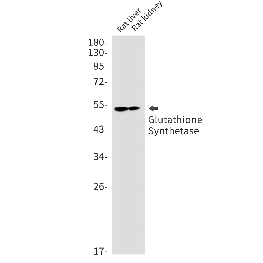 Glutathione Synthetase Rabbit Monoclonal Antibody