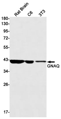 GNAQ Rabbit Monoclonal Antibody