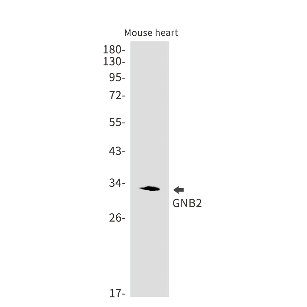 GNB2 Rabbit Monoclonal Antibody