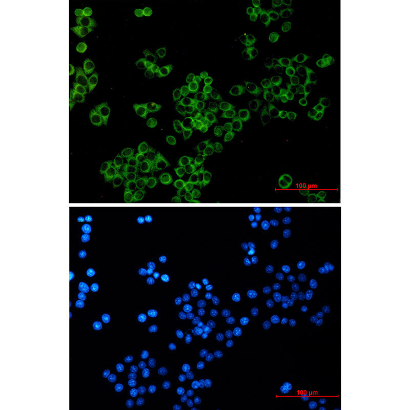 LGR6 Rabbit Monoclonal Antibody