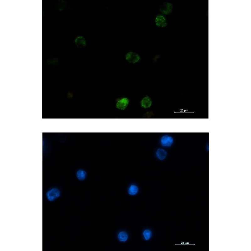 Hexokinase I Rabbit Monoclonal Antibody