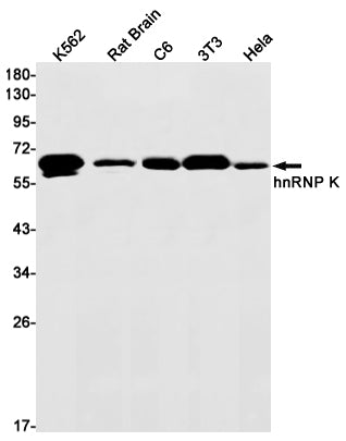 hnRNP K Rabbit Monoclonal Antibody