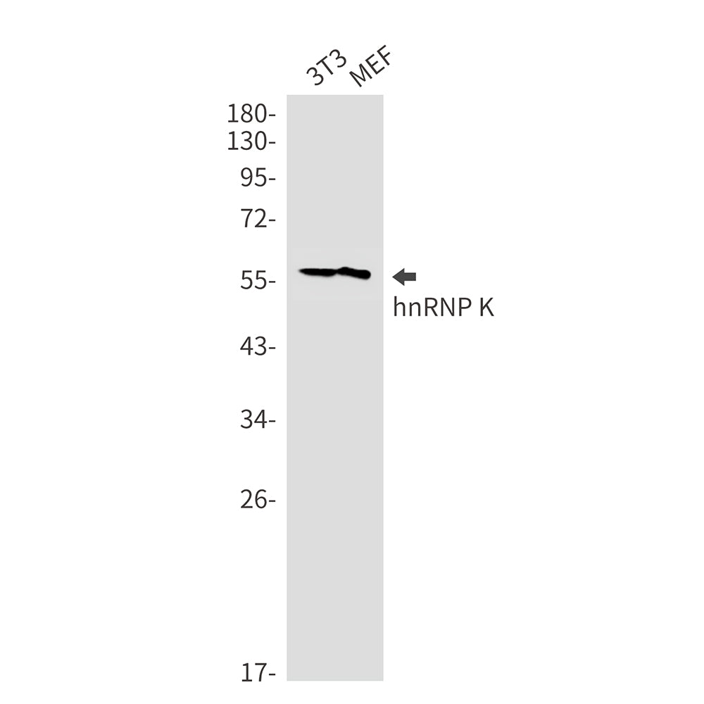 hnRNP K Rabbit Monoclonal Antibody