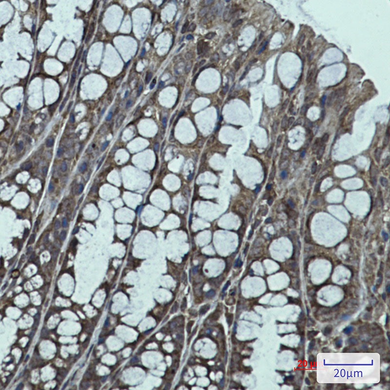 IGF2BP1 Rabbit Monoclonal Antibody