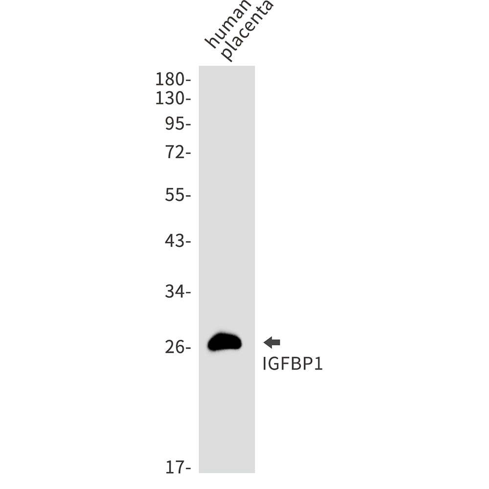 IGFBP1 Rabbit Monoclonal Antibody
