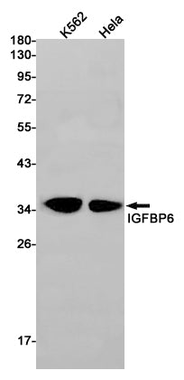 IGFBP6 Rabbit Monoclonal Antibody