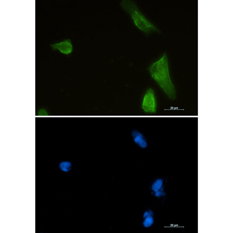 IKK beta Rabbit Monoclonal Antibody