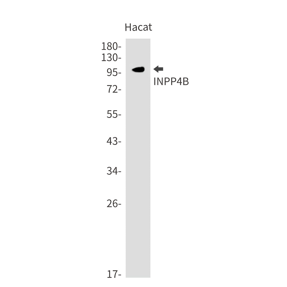 INPP4B Rabbit Monoclonal Antibody