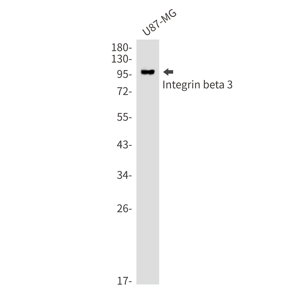 Integrin beta 3 Rabbit Monoclonal Antibody