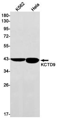 KCTD9 Rabbit Monoclonal Antibody