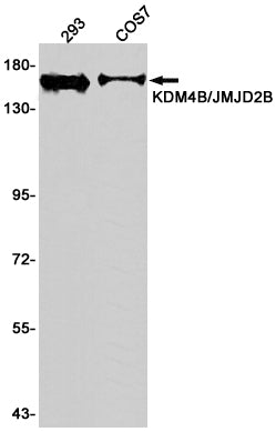 KDM4B Rabbit Monoclonal Antibody