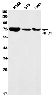 KIFC1 Rabbit Monoclonal Antibody