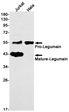 Legumain Rabbit Monoclonal Antibody