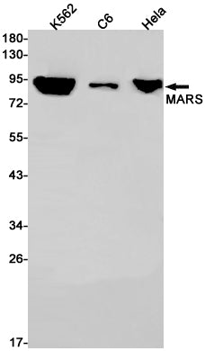 MetRS Rabbit Monoclonal Antibody