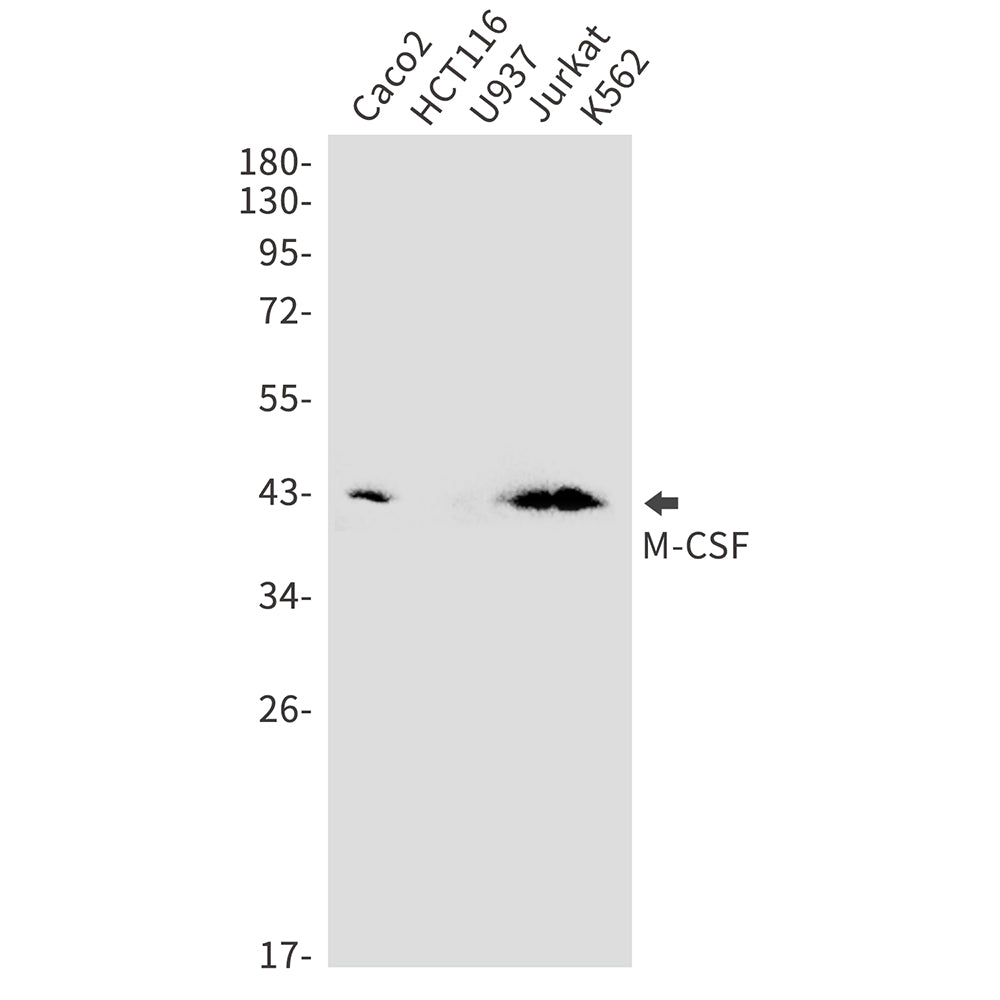 M-CSF Rabbit Monoclonal Antibody