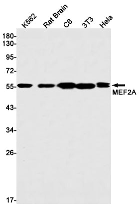 MEF2A Rabbit Monoclonal Antibody
