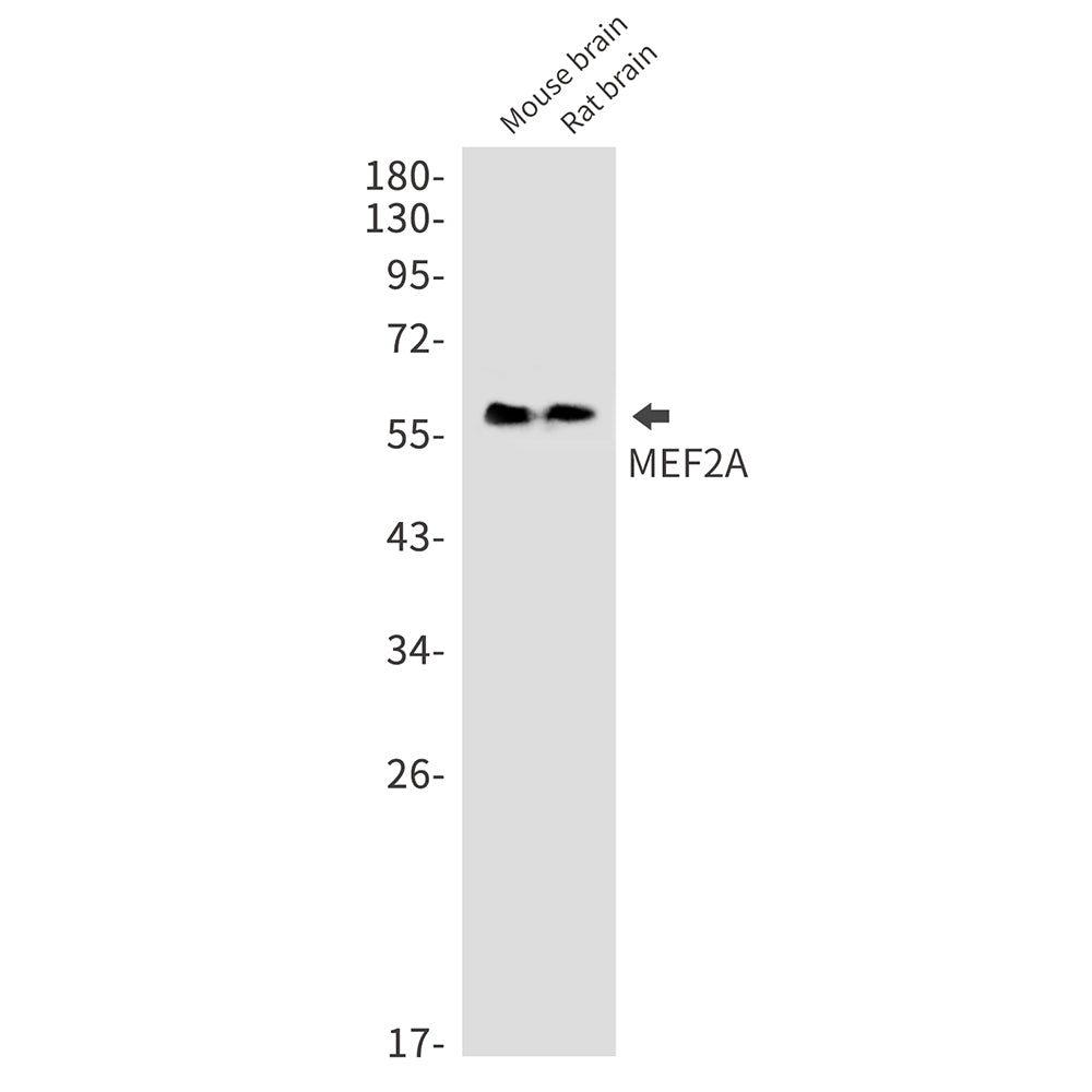 MEF2A Rabbit Monoclonal Antibody